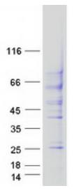 SDS-PAGE (TGFBR2-4439H).jpg